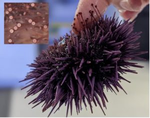 A purple urchin presented with a magnified section